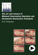 The Art And Science Of Minimal Intervention Dentistry And Atraumatic Restorative Treatment