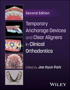 Temporary Anchorage Devices and Clear Aligners in Clinical Orthodontics (2nd Edition) 